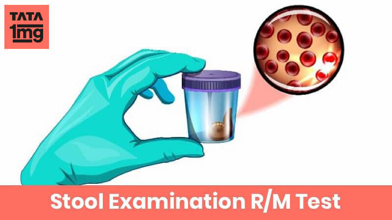 Stool Examination R/M